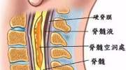 这些症状出现是脊髓在报警，严重可瘫痪！