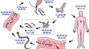 糖尿病人易发生4种感染，学会两招，很有必要