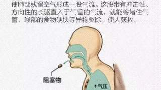 比心肺复苏还重要的海姆立克急救法，护士们赶紧练起来吧！