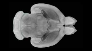 科学家成功逆转大脑干细胞的衰老过程有望开发返老还童新方法