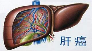 为什么这8类人肝癌高发？快看看你是不是