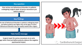 EJCTS:早期手术可能改善漏斗胸患儿的心理行为异常