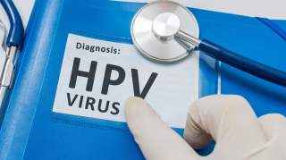 女子感染HPV，原因竟是丈夫不检点！三大传播方式，得防着点儿