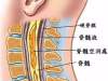 这些症状出现是脊髓在报警，严重可瘫痪！