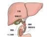 北京中山医院科普：节假日暴饮暴食警惕胆囊结石