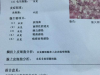 【HPV阳性，TCT报告单没这2个指标，别听医师去做锥切】