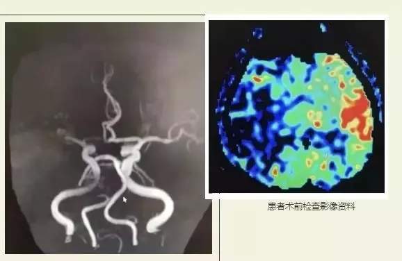 慧眼识疾 开滦总医院成功挽救“健康人”