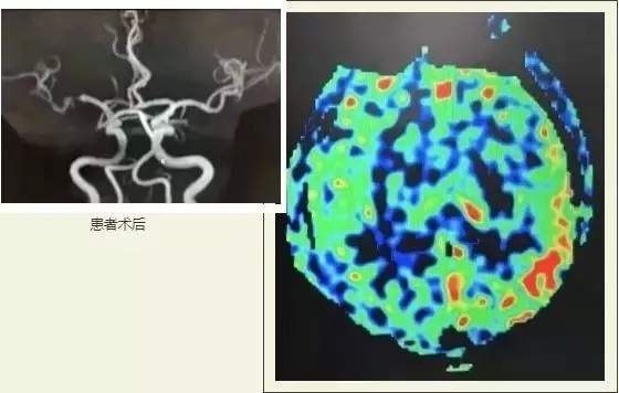 慧眼识疾 开滦总医院成功挽救“健康人”