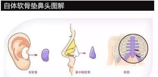 她因赵丽颖一夜爆红，和杨幂抢老公，脸上竟有个最大BUG