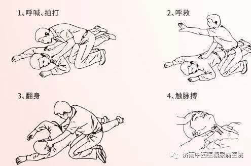 心脏骤停遇6名医生抢救捡回一命——人人都应该学习的心肺复苏术