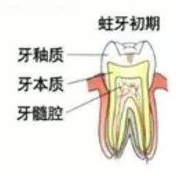 警惕，一条黑线可能吞噬你整颗牙！