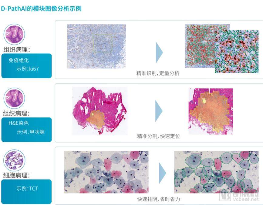 千亿规模的病理市场，能否成为AI初创企业的新出口？