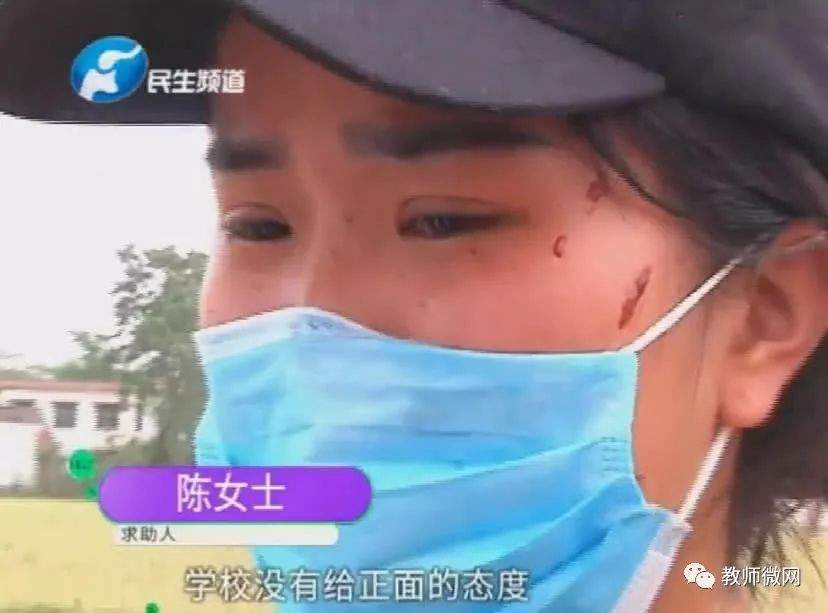 河南90后女教师被家长抓破脸毁容！学校态度更让人寒心