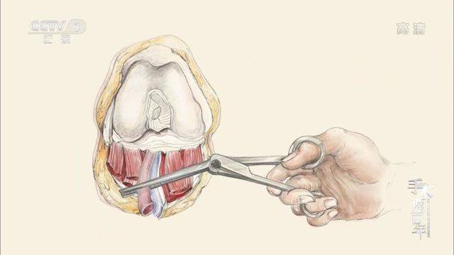 200年前的手术有多可怕，我们今天的医学就有多伟大