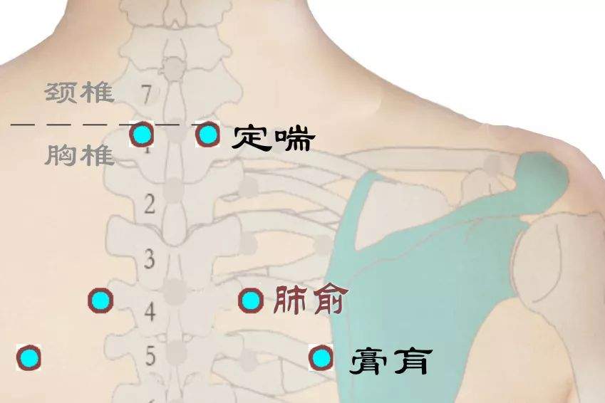 关于敷贴药物与选穴