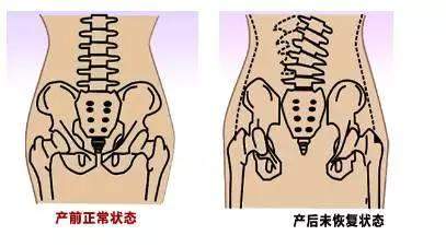 坐好月子是产后恢复的最基础，但这些身体部位恢复好才是重中之重！