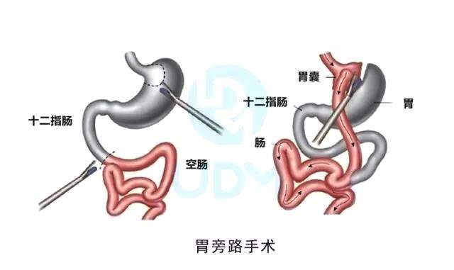 身材肥胖若出现这4信号说明你的健康正被侵蚀