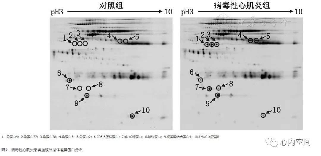 病毒性心肌炎患者血浆外泌体生物标志物蛋白质组学筛选