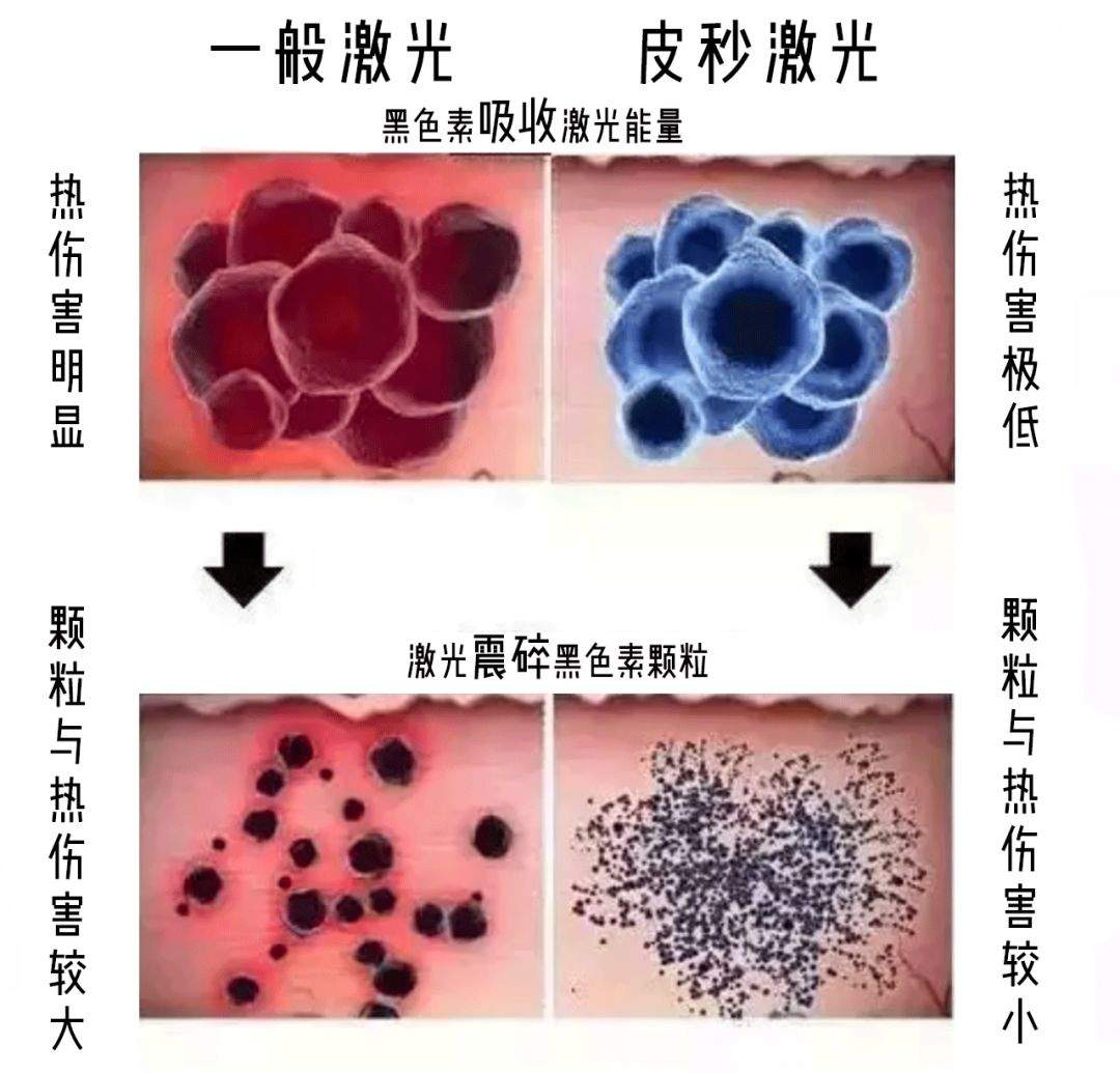 我做得最多的医美项目！超有效！