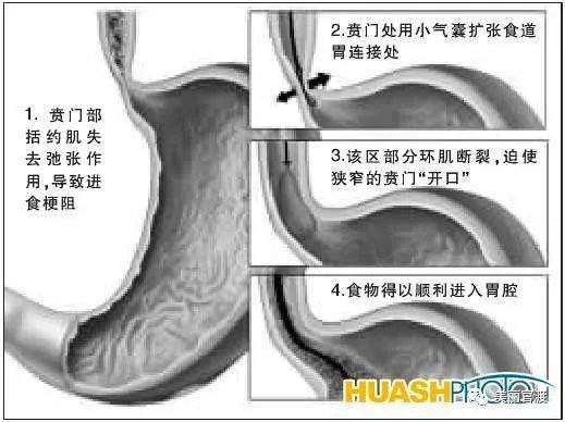 北京教授为啥给云南罪犯亲自做手术？