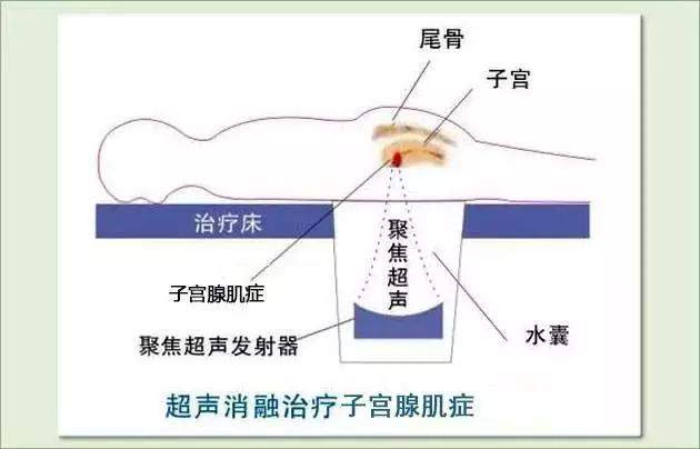 海扶刀-曾经害怕被骗，如今赶来代言