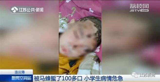 小学生放学路上被“袭击”，直接进了ICU！安徽也曾发生多起……