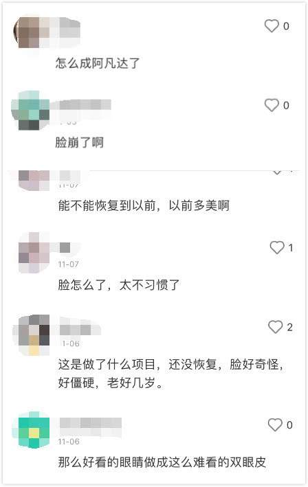 有种“整容”叫张雨绮近照，前后判若两人，脸僵鼻歪神似阿凡达