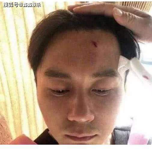 浙江卫视嘉宾又出事：高以翔猝死，李晨缝针，海清摔伤，更有人溺水身亡