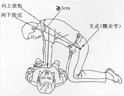 活命不能总指望运气，成都卫健委公布全市AED配置点位，速收藏