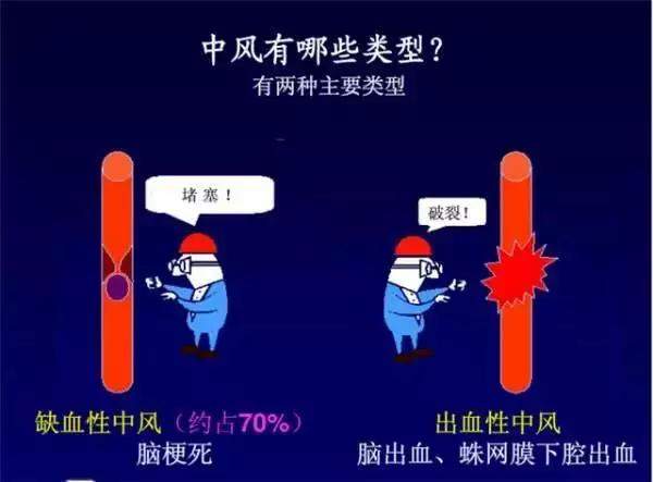 天冷了，冬季杀手来了！——中风的防治康复