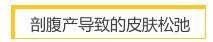 剖腹产后遗症有哪些症状，必须要重视的问题！