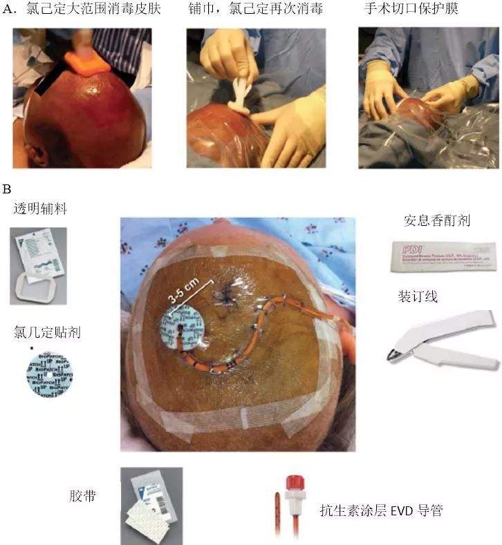 超详细丨脑室引流感染防控流程