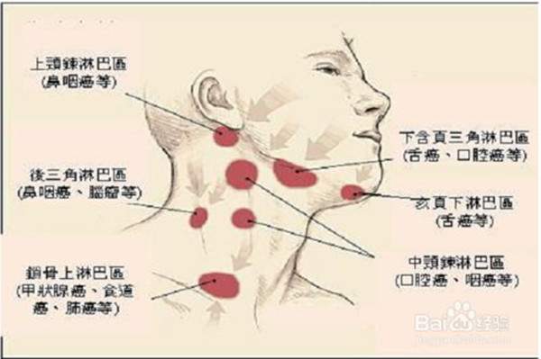 人体的淋巴结是怎么形成的 淋巴结需要注意些什么