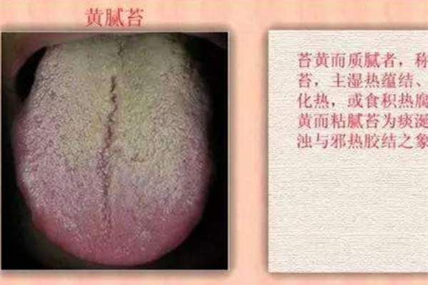 女性寒湿体质的症状 湿热体质和寒湿体质有什么区别