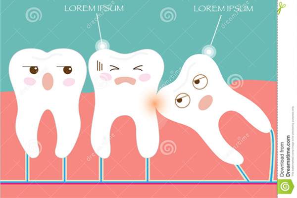 智齿不疼需要拔吗 不疼也必须拔掉的四种情况