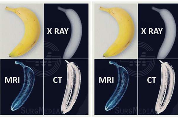 X光线核磁共振和CT的区别 一张图看懂三者区别