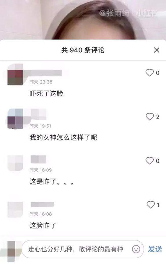 张雨绮鼻孔一高一低疑似整容？正主出面辟谣：都是滤镜的锅