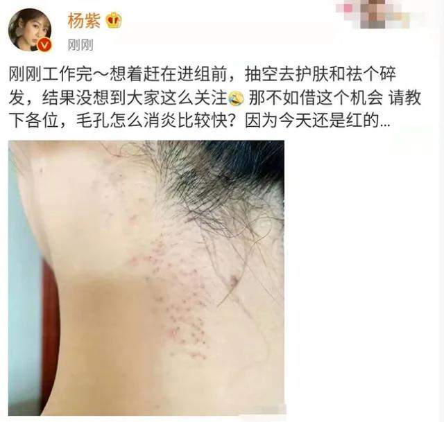 杨紫再次回应整容传闻，辟谣方式堪称女星典范，尽显高情商