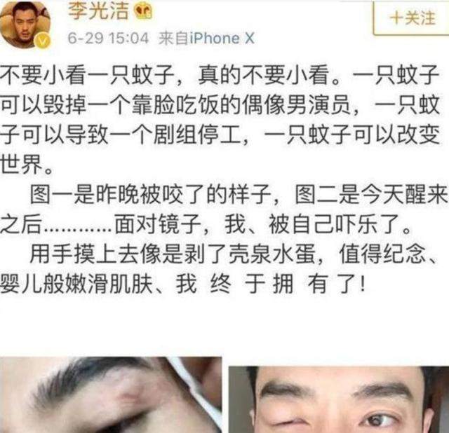 整个剧组全面停工，本以为是“明星耍大牌”，却仅仅是一只蚊子