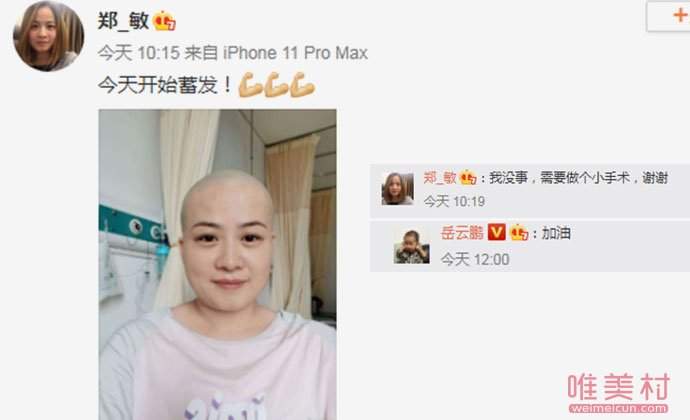 岳云鹏老婆回应生病剃光头 半年两次剃光头发生了什么病