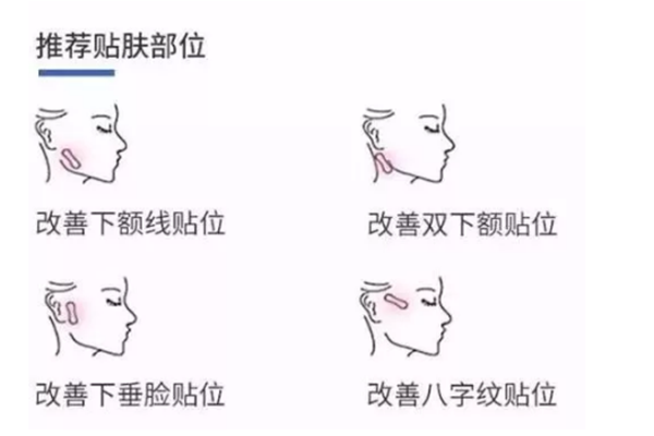 抖音上韩国瘦脸贴有用吗？真的可以达到V脸效果吗？