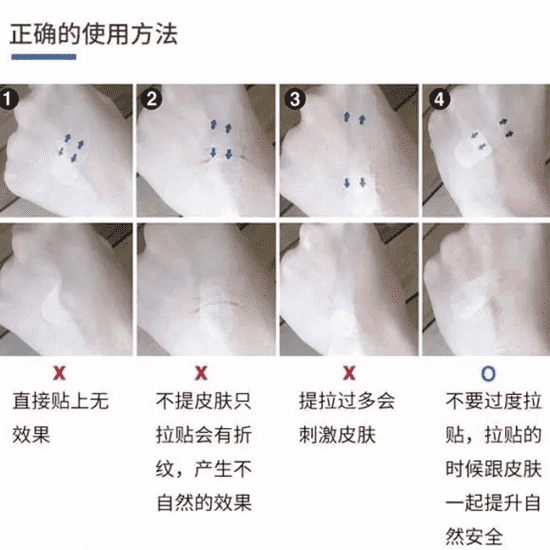 韩国瘦脸贴有用吗 瘦脸贴是否可以用双眼皮贴替代