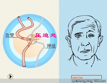 左眼跳财右眼跳灾是真的吗 你该休息了