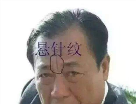 两眉间有竖纹，运势会相应的跟着改变！