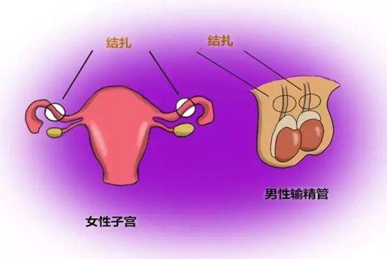 不戴套8种避孕方式，各有利弊！