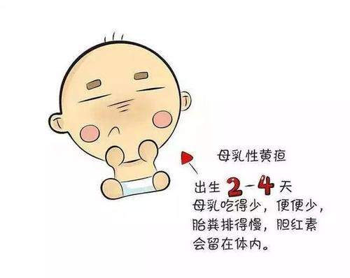 母乳性黄疸怎么办？小编分享三种方法